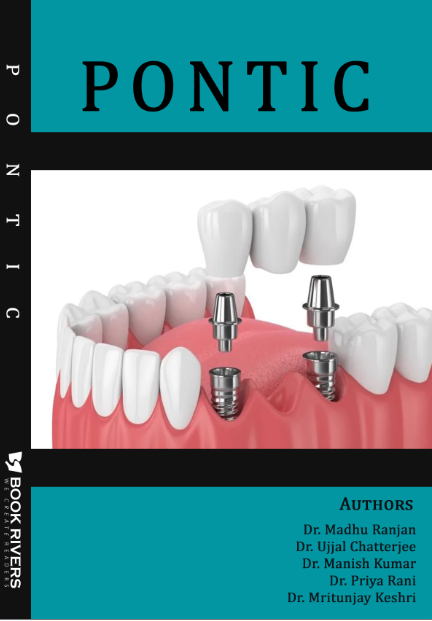 PONTIC