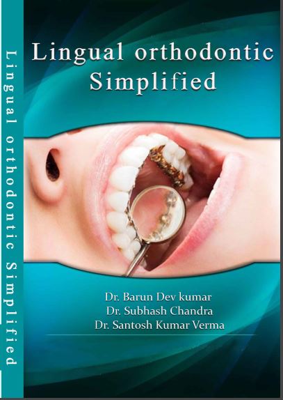 LINGUAL ORTHODONTIC SIMPLIFIED