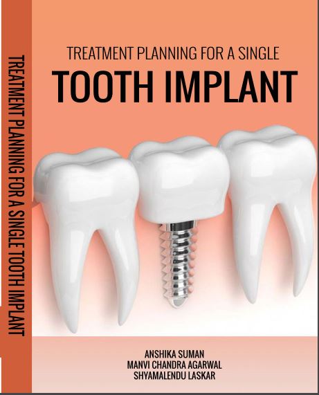 TREATMENT PLANNING FOR A SINGLE TOOTH IMPLANT