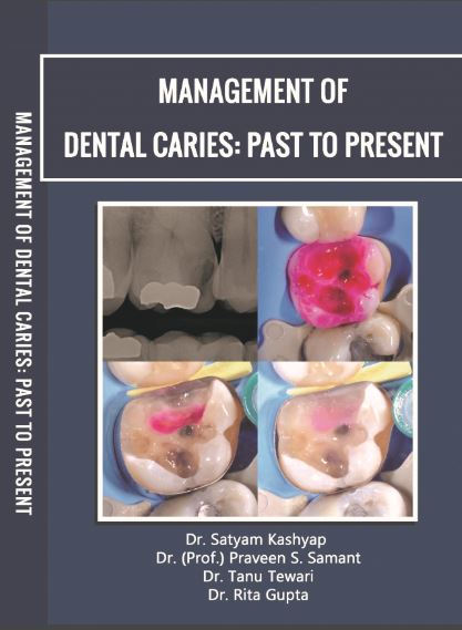MANAGEMENT OF DENTAL CARIES:  PAST TO PRESENT