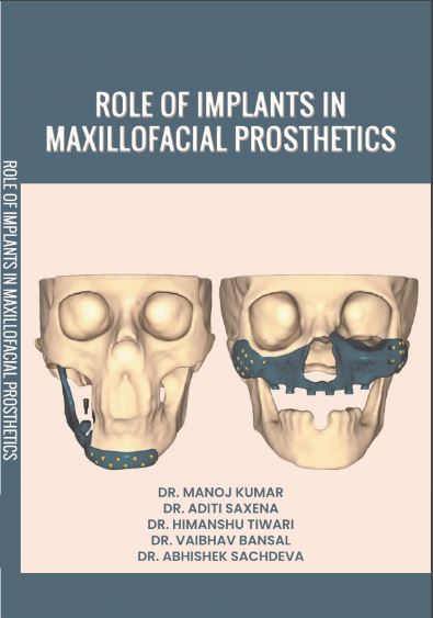ROLE OF IMPLANTS IN MAXILLOFACIAL PROSTHETICS