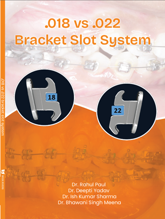 0.018 VS 0.022 Bracket Slot System