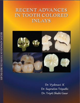 Recent Advances In Tooth Colored Inlays