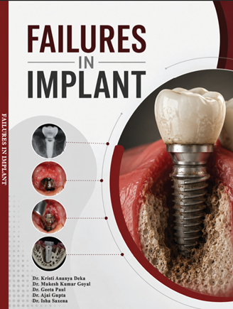 Failures in Implant